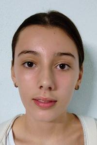 Cloe Bonmatí