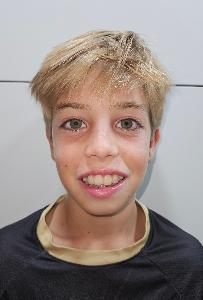 Lucas Coves